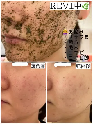 Fleur フルールのエステ・リラクイメージ