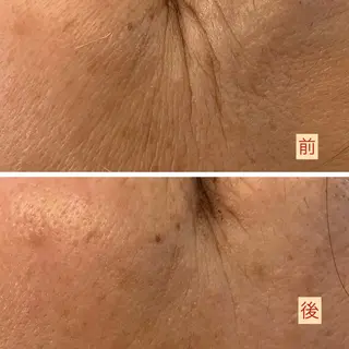 たるみ改善小顔エステ 堀葉月のその他イメージ