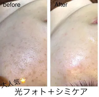 エヴァーグレース 河原町店のエステ・リラクイメージ