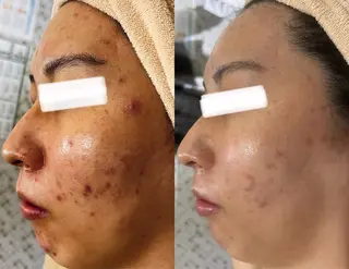 小顔&美肌品川店 Masqueradeのエステ・リラクイメージ