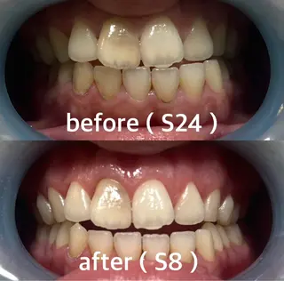 九州オーラルホワイトニング所属・田中 毬亜/薬院警固店のエステ・リラクイメージ