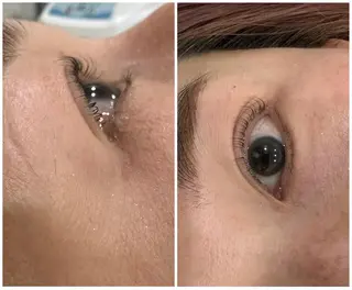 マツエク・マツパ Lino me 島谷夢奈のエステ・リラクイメージ