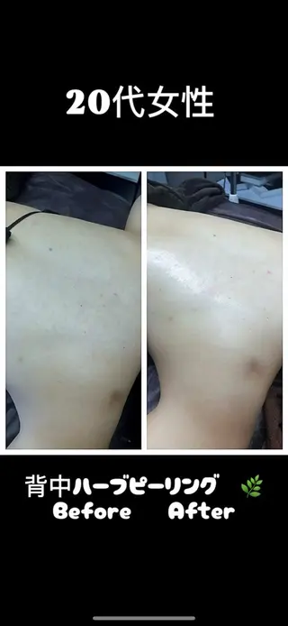 美容整体・塗る漢方・フェイシャルRechica所属・心斎橋痩身 美肌整体サロン💓のエステ・リラクイメージ