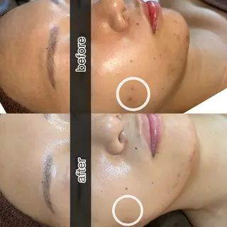 四ツ橋フェイシャル Rebornのエステ・リラクイメージ