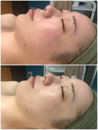 ブライダルエステ専門 入谷友莉のエステ・リラクイメージ