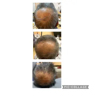 【天神・大名】脱毛/ ハーブ植松७९०のエステ・リラクイメージ