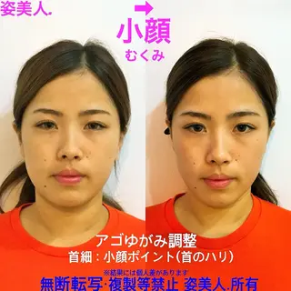 筋膜整体＆小顔矯正 　姿美人.シルエットのエステ・リラクイメージ