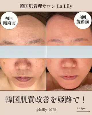 韓国肌管理サロン La Lily所属・韓国肌管理サロン La Lily 上田のエステ・リラクイメージ