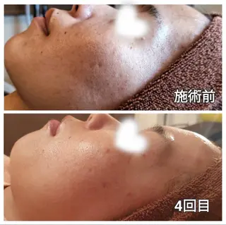 salon lady_goのエステ・リラクイメージ