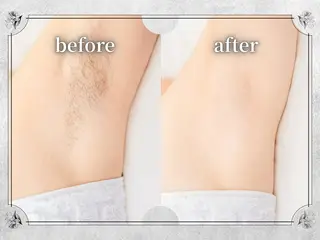 Lino by MIRA/Yuinaのエステ・リラクイメージ