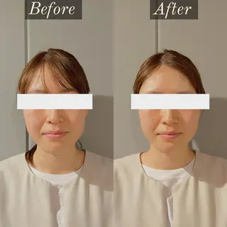 美容鍼灸整体サロンBeAu所属・美容鍼灸師 川口 愛華のエステ・リラクイメージ