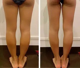 ハイパーナイフEX 小顔×痩身ケアのエステ・リラクイメージ