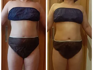 charmant (シャルマン)所属・エステサロン charmantのエステ・リラクイメージ