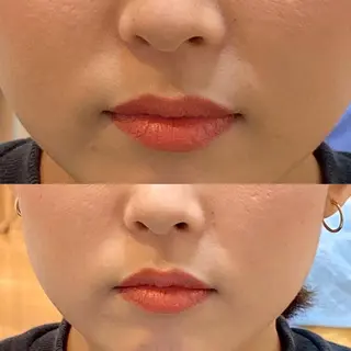 鍼灸整体院　蕾所属・美容鍼 蕾【谷町六丁目】のエステ・リラクイメージ