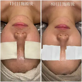 中尾 朱里のエステ・リラクイメージ