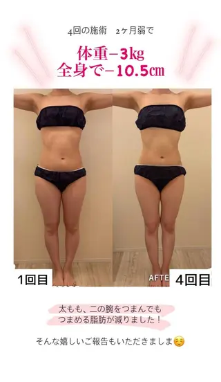 産後ダイエット−9㎏ Pourvous結衣のエステ・リラクイメージ