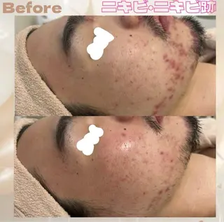 都度払い肌改善専門店 店長二上文香のエステ・リラクイメージ