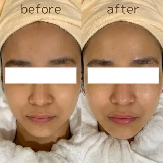 pansy(パンジー)上野フェイシャルエステ専門店所属・pansy saraのエステ・リラクイメージ