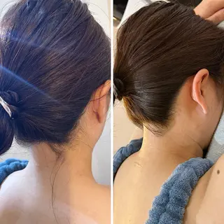 うなじ脱毛/美肌脱毛 LABELのエステ・リラクイメージ