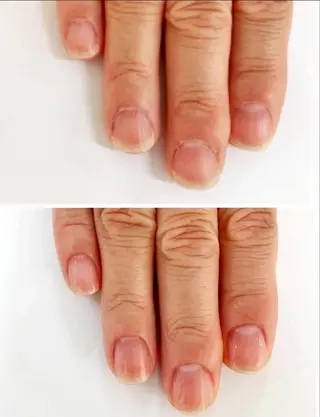 ネイル 奥園 良恵のネイルデザイン