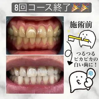 ホワイトニングカフェ藤が丘店所属・ホワイトニングカフェ 藤が丘のその他イメージ