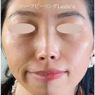 美腸サロン🌺 腸もみ/小顔/リンパのエステ・リラクイメージ