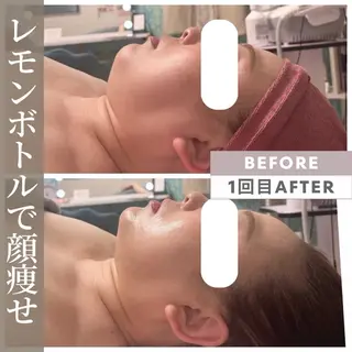 【小顔リフト×小顔矯正専門店】RED所属・猿渡 ひかるのエステ・リラクイメージ