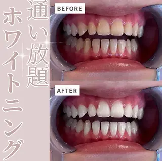 エクシア仙台駅東口店所属・セルフホワイトニング エクシア仙台駅東口店のその他イメージ