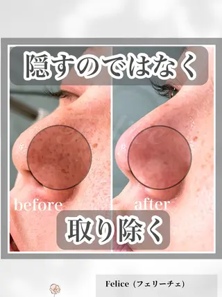 毛穴ケア✖️まつげ Feliceのマツエク・マツパデザイン