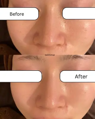 南森町・肌質改善 BELMIMARのエステ・リラクイメージ