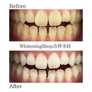 ホワイトニング ショップ吉祥寺店のエステ・リラクイメージ