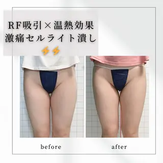 小顔矯正専門店 【RED】池田のエステ・リラクイメージ