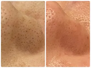 Hisui 小出のエステ・リラクイメージ