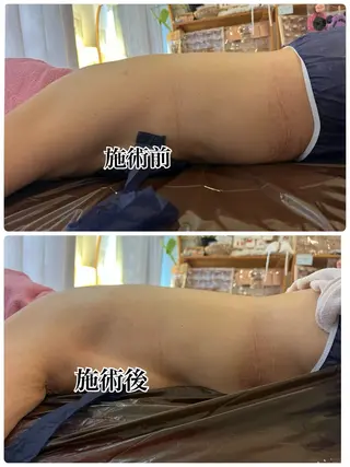 ❤︎MN❤︎ モンのエステ・リラクイメージ