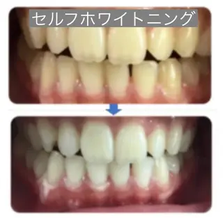 R.S.Land メンズ脱毛/エステのエステ・リラクイメージ