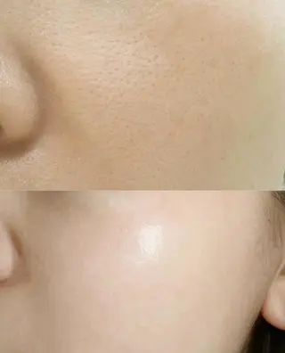 ネイル メンズ aliaハイフ&水光ジェットサロン所属・aliaハーブ水光店 エステティシャン募集のエステ・リラクイメージ