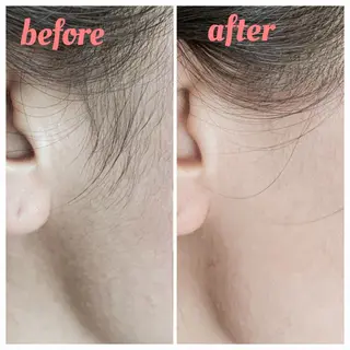 脱毛サロンLULA 恵比寿店　笠松のエステ・リラクイメージ