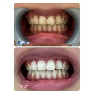 M渋谷店所属・M渋谷 ホワイトニングのエステ・リラクイメージ