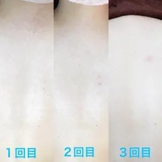 男女同額完全個室脱毛 LEPIA内田のエステ・リラクイメージ