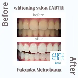 メンズ ホワイトニングサロン EARTH福岡姪浜店のその他イメージ