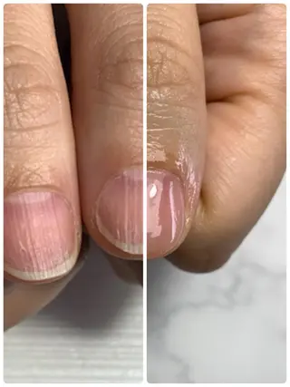 ネイル 大橋 愛のエステ・リラクイメージ