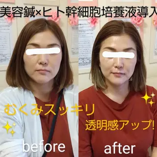 【妊活・美容鍼専門】Aran鍼灸院所属・【美容鍼・不妊専門】 Aran鍼灸院のエステ・リラクイメージ