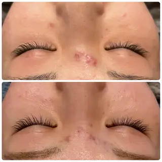 yellow.所属・yellow💛【 脱毛&フェイシャル】のエステ・リラクイメージ