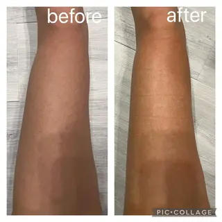 M.rose エムローズのエステ・リラクイメージ