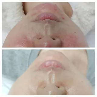 loa まつ毛と肌管理のお店のマツエク・マツパデザイン