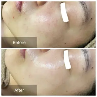 バフトアップ/ハーブ Nornのエステ・リラクイメージ