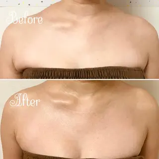 透明感の肌Lino malieのエステ・リラクイメージ