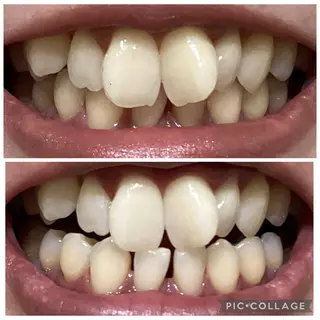 セルフホワイトニングサロン　Betee所属・セルフホワイトニング Beteeのエステ・リラクイメージ