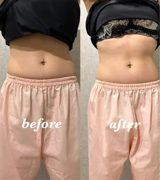 腸活サポート みなみののエステ・リラクイメージ