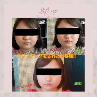 耳つぼジュエリー　シエル所属・大西 海那のその他イメージ